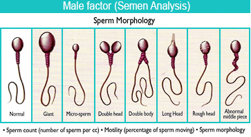 developed fully When sperm is